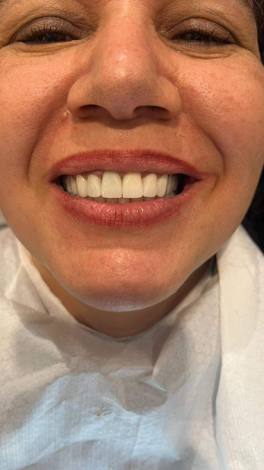 ECE Dental Patient Transformation